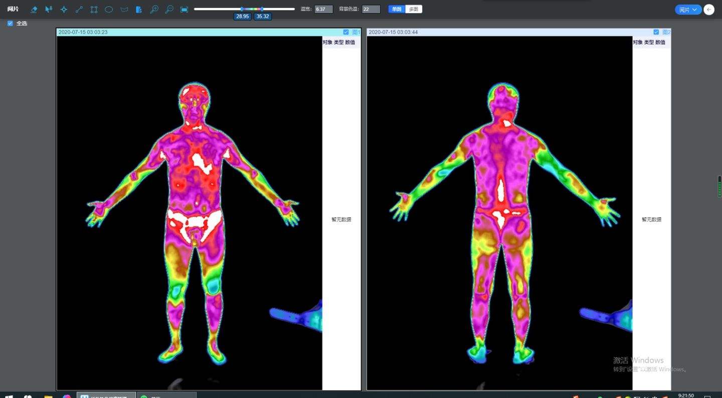 疫情環境下，為什么紅外熱成像設備要比額溫槍有效率？